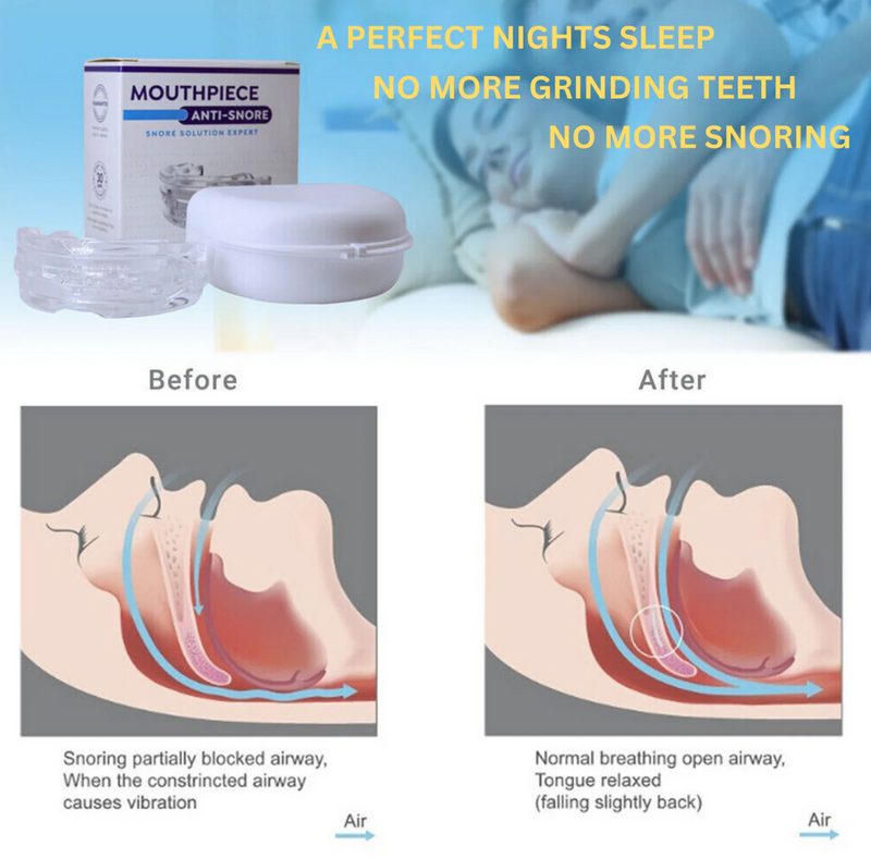 SilentGuard Anti-Snoring Mouthpiece - Relax Australia